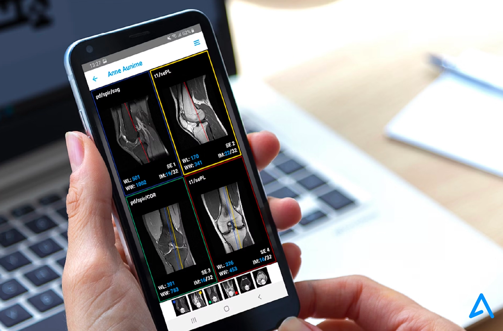 mobile medical image viewing